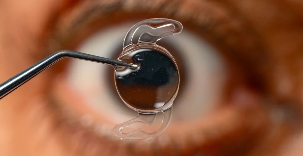 Akıllı Lens ve Katarakt: Hangi Mercek Size Uygun?