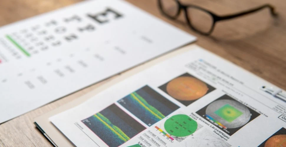 Diyabetik Retinopati: Diyabetliler İçin Göz Kontrol Takvimi